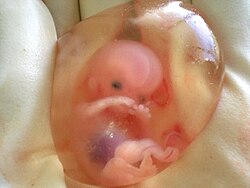 Человеческий плод