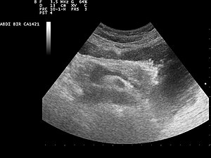 Ультразвуковое изображение поджелудочной железы