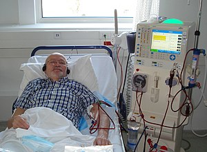 Пациент на диализе