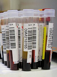 Blood test.jpg