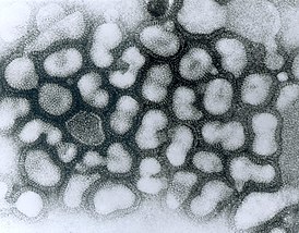 Вирус птичьего гриппа на электронной микрофотографии