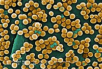 CDC-10046-MRSA.jpg