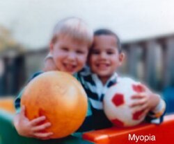 изображение при миопии